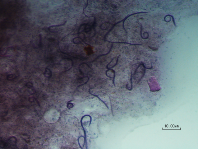 Adult Strongyloides