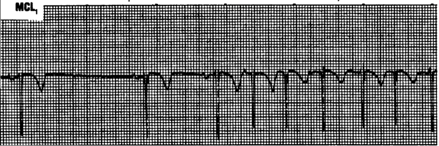 Heart graph
