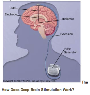 fig3