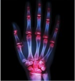 hand