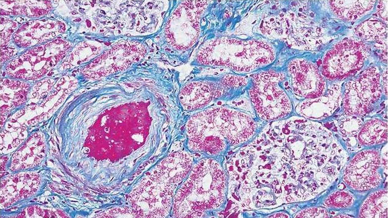 
                         Histology                                                    - 
                          Kidney tissue stained with Masson trichrome.  Connective tissue in blue, nucleus in red/purple and cytoplasm in pink.                                                    