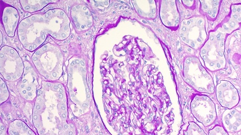 
                         Histology                                                    - 
                          Periodic acid–Schiff (PAS) staining of glomerulus in the kidney. A staining method used to detect polysaccharides such as glycogen, and mucosubstances such as glycoproteins, glycolipids and mucins in tissues.                                                    