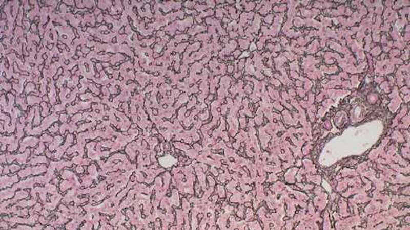 
                         Histology                                                    - 
                          Reticulum stain of liver cells.  This stain highlights the reticular fibers                                                    