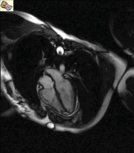 Cardiac-MRI-long-axis-RV.gif