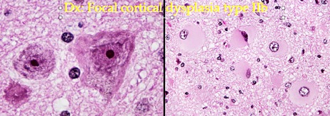 Further microscopic images