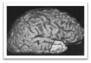 Image of the brain with temporal lobe highlighted