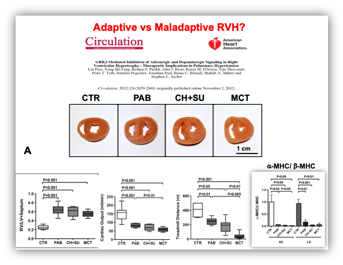 chart showing adaptive vs maladaptive RVH