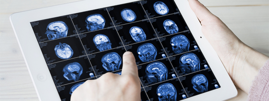 Neuroimmunology & Multiple Sclerosis