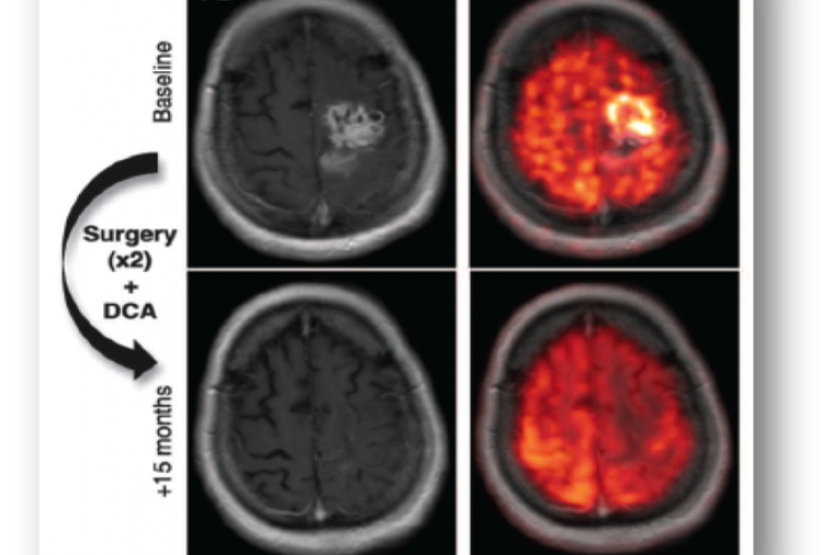Regulatory Fundamentalism: Is persnickety regulatory rigor impeding clinical trials and paradoxically reducing patient safety?