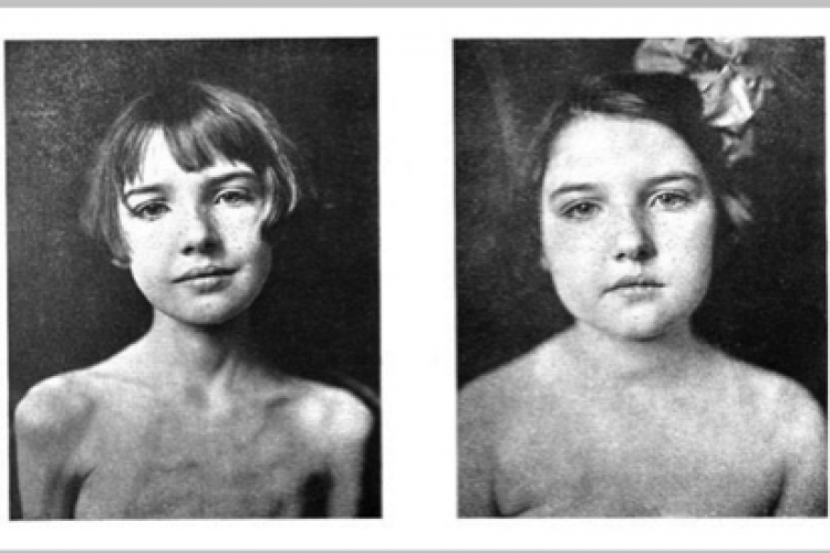 Animals in Biomedical Research: What they have given us and what we owe them