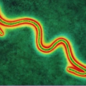 The Ebola Epidemic of 2014 - The Revenge of Die Fledermaus